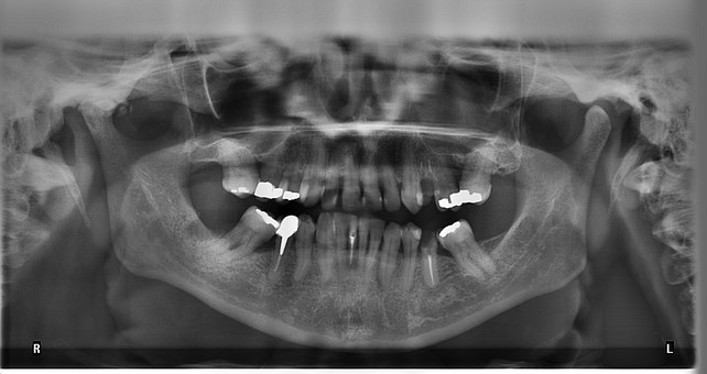 dentaloniki.χειρουργική.στόματος05
